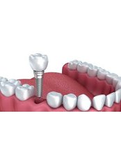 Dentist Consultation - Advis dental