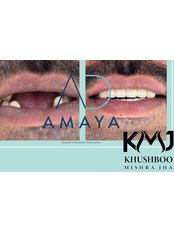 DSD - Digital Smile Design - Amaya Dental Clinic