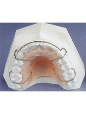 Orthodontic Retainer - Arun Dental Clinic