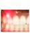 Bala Dental Clinic - laser-dentistry 