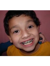 Child Braces - Bala Dental Clinic