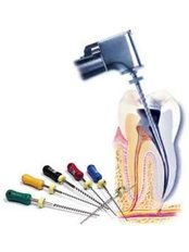 Root Canals - Dental Planet