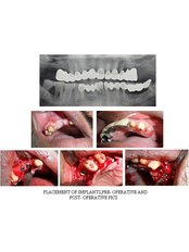 Dentist Consultation - Dental Planet