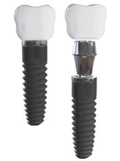 Dental Implant - Reginolds Dental Care
