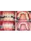 Smile Architect Invisible Braces Center - Orthodontic treatment  
