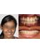 Smiles n More Orthodontic & Invisalign Centre - 318/A,24th cross, 27th main, behind Superfoods,, sector 2, HSR Layout, Bangalore, Karnataka, 560102,  27