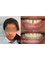 Smiles n More Orthodontic & Invisalign Centre - 318/A,24th cross, 27th main, behind Superfoods,, sector 2, HSR Layout, Bangalore, Karnataka, 560102,  20