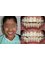 Smiles n More Orthodontic & Invisalign Centre - 318/A,24th cross, 27th main, behind Superfoods,, sector 2, HSR Layout, Bangalore, Karnataka, 560102,  21