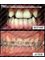 Smiles n More Orthodontic & Invisalign Centre - Braces for teeth alignment 