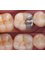 Sai Oral And Dental Care Center - 304 Gautam Nagar, Bhopal, Madhya Pradesh, 462023,  4