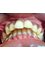 YourDentist dental clinic - dental braces before 