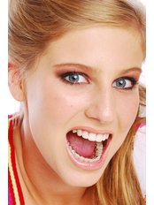Lingual Braces - Dentique Calicut