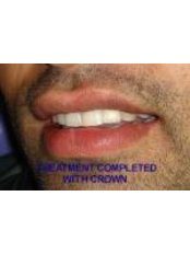 Cosmetic Dentist Consultation - 32 Smilez Dental Clinic & Implant Center