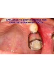 Paediatric Dentist Consultation - 32 Smilez Dental Clinic & Implant Center