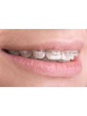 Orthodontist Consultation - 32 Smilez Dental Clinic & Implant Center