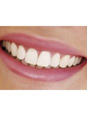 Keyhole Dental Implants - Avance Dental Care