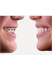 Orthodontist Consultation - Chennai Dental Clinic
