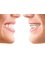 Sparks Cosmetic & Dental Surgery - Invisible braces-invisalign, clearpath 