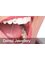 Dr.Sharma's Smile Signature: The Dental Clinic - 54-55, DDA Mini Market, Plot No.13-14, (Adjacent Post Office), Sector-6,Dwarka, New Delhi, Delhi, 110075,  11