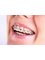 Dr.Sharma's Smile Signature: The Dental Clinic - 54-55, DDA Mini Market, Plot No.13-14, (Adjacent Post Office), Sector-6,Dwarka, New Delhi, Delhi, 110075,  5