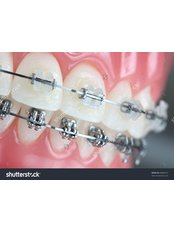 Dentist Consultation - Alpha Smile Dental Clinic