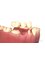 AMAR Dental Clinic - Missing Teeth are not in fashion these days. Get a bridge.. 