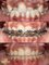 COSMODENT INDIA - Dental Braces 
