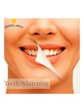 Teeth Whitening - Dental Arch Gurgaon