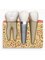 Haldwani dental clinic - dental implants 