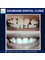 Shubham Dental Clinic - Smile makeover- Shubham Dental Clinic Hisar 