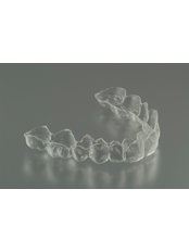 Orthodontic Retainer - Ishika Dental Clinic