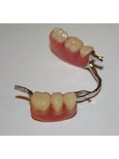 Removable Partial Dentures - Ishika Dental Clinic