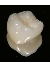 Porcelain Crown - Ishika Dental Clinic