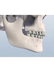 Orthognathic Surgery - Ishika Dental Clinic