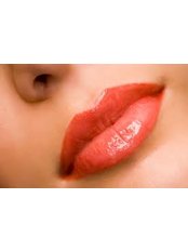Lip Augmentation - Ishika Dental Clinic