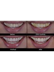 Smile Design - Orient oral care