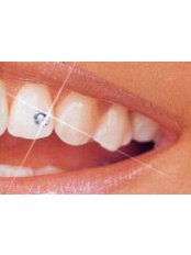Tooth Jewellery - Arora's Dental Planet