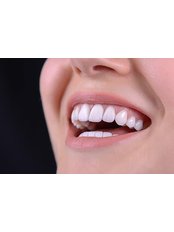 Dentist Consultation - Perfect Dental