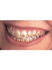Orthodontist Consultation - Dental Clinic Kochi