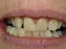 Kirans Dental Clinic-Vypeen