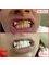 Amazing Smiles - Dental Scaling 