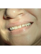 Tooth Jewellery - Amazing Smiles
