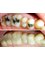Apurva Dental Care - BD-25, Sector-1, Salt Lake, Kolkata, West Bengal, 700064,  4