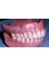 Medicure Polyclinic - Complete Denture 