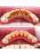 Medicure Polyclinic - Scaling Before & After 