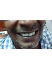 S.S.Dey Eye & Dental Clinic - after treatment 1 