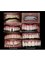 32 Pearls Multispeciality Dental Clinic - C 303, 304, Sahara Plaza patrakarpuram, Gomti nagar, Lucknow, Uttar Pradesh, 226010,  37