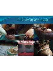 Implant Dentist Consultation - Rama Dental Clinic