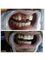 Beyond smiles dental clinic - shop no. 3 vishal nagar chownk, near anmol hospital , opp. kanchan colony, vishal nagar extention, pakhowal road., ludhiana, punjab, 141013,  5