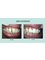 Beyond smiles dental clinic - shop no. 3 vishal nagar chownk, near anmol hospital , opp. kanchan colony, vishal nagar extention, pakhowal road., ludhiana, punjab, 141013,  2